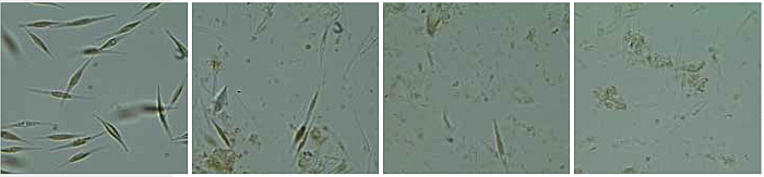 Phaeodactylum tricornutum Zellen 